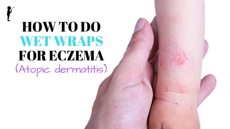 How to do wet wraps for eczema. #Naturopathic!